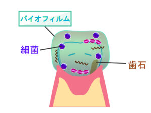 バイオフィルム