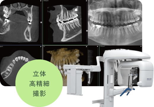 立体高精細撮影